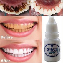 1 Bottle 10 Ml Teeth Whitening Mouth Cleaning Liquid Whitening Dental Tools - $5.99