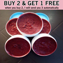 Buy 2 Get 1 Free | Red Burn Treatment 100g | دواء الحروق الأحمر 100غرام - £34.59 GBP