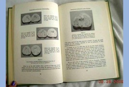 1965 Vintage Orofacial Abnormalities Medical Book Cleft Pallet Du Pont Nemours - £23.05 GBP