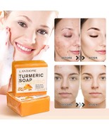 Turmeric AntiAcne Soap Clear Skin  Lighten Spots - $355.98 MXN+