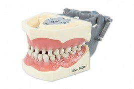 Dental Typodont Model 860 Prep Teeth Model Fits Columbia Brand Removable Teeth - £33.56 GBP