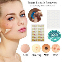 Skin Tag Remover Patch Hydrocolloid Acne Pimples Warts Moles Corn Care Beauty - £8.58 GBP+