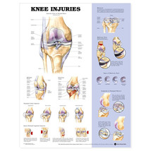 The Knee Injuries Anatomical Charts 20x26 - £16.98 GBP+