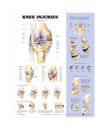 The Knee Injuries Anatomical Charts 20x26 - £17.31 GBP+