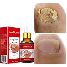 New Nail Fungal Treatment Feet Care Essence Nail Foot Whitening Toe Nail - £20.24 GBP