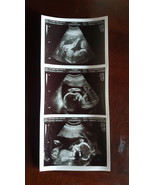 REAL US PAPER Fake Prank Gag Custom Positive Pregnancy 2D Ultrasound Son... - $41.00