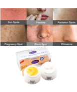 Crema para pecas blanqueadora de manchas oscuras para hombres y mujeres ... - $19.75