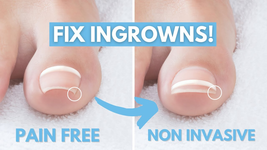 Fuzion UV/LED Nanoflex Conceal Toe Nail Restore Sampler Kit image 3
