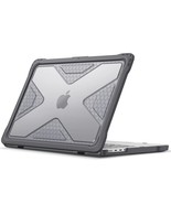 Fintie Case for MacBook Pro 14 Inch A2779 A2442 (2023 2022 2021 Release)... - £49.61 GBP
