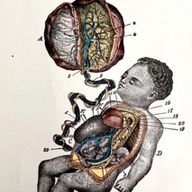 Fetus In Utero With Appendages 1878 Victorian Medical Anatomy Color Print DWV6A - £47.84 GBP