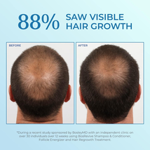 BosleyMD Men's Hair Regrowth Spray 5%, 2 Oz. image 3