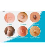 Salicylic Wart Removal Freeze Away: Fast-Acting Wart Removal Maximum Str... - €12,79 EUR