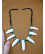 (G157-70) big 1-3/4&quot; GATOR T**TH onyx + turquoise 22&quot; Necklace Alligator... - $2,576.02 MXN