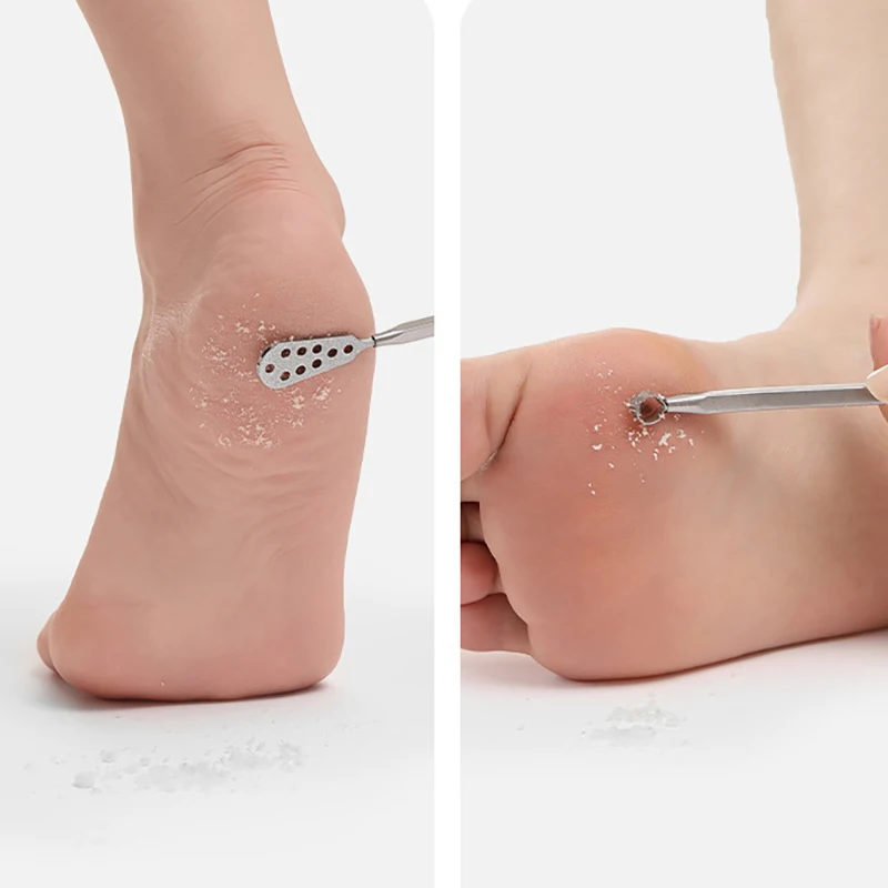 Stainless steel Feet Nail Ingrown Cuticle Pedicure Knife Set Toe nail Sc... - £8.70 GBP+