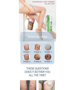 Blue Light Laser Treatment for Varicose Veins - $137.13 CAD