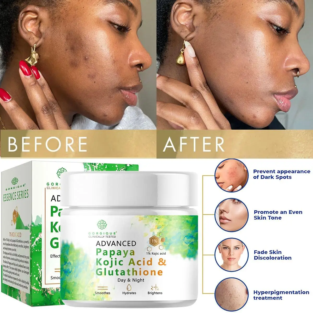  Kojic Acid Glutathione Resurfacing Spot Corrector Whitening Cream 50g - $15.95