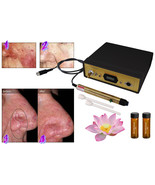 New Laser Spider Vein Capillary Removal Machine System + Kit, Permanent ... - $1,388.68 CAD