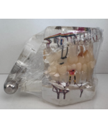 Sealed Dental Teeth Model Ortho Implant Bridge Disorder Demo Study Model - $49.49