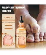 Anti-Nail Groove Relief Oil, Repair Inlaid Nails Gray Nails And Soft Thi... - $20.50