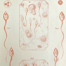 Human Male Seminal Fluid 1878 Victorian Medical Anatomy 1 Color Print DWV6B - £23.91 GBP