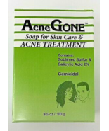Acne Gone Soap Acne Treatment bar - $21.47 CAD