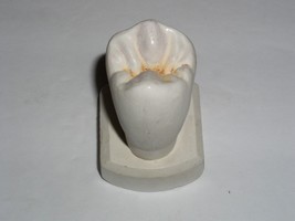 Dental Tooth Model Plaster Cast Anatomy Morphology Teaching Upper 2nd Bi... - £14.14 GBP