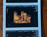 REAL US PAPER Fake Prank Custom Positive Pregnancy 3D COLOR Ultrasound S... - $165.00