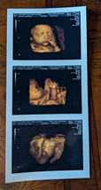 REAL US PAPER Fake Prank Custom Positive Pregnancy 3D COLOR Ultrasound S... - $165.00