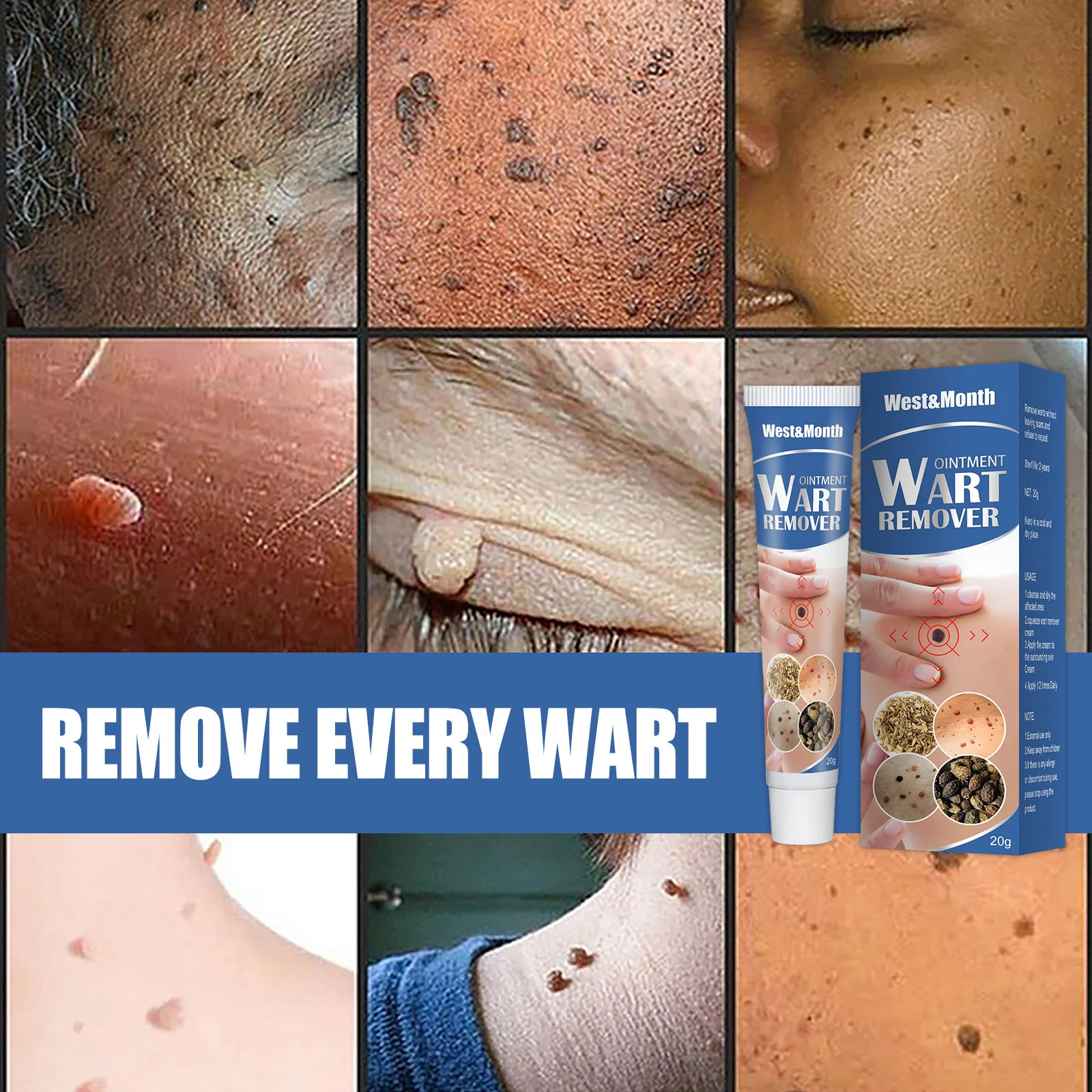 Skin Tags Remover Cream Warts Remove Ointment Treatment Neck Armpit Flat Genital - £93.94 GBP