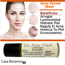 Acne Serum Mask and all skin treatment Casa Botanica - $18.00