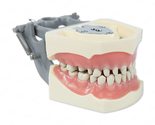 Dental Typodont Model 860 Prep (Crowns and Occlusal Cavities) 32 Removab... - $42.99