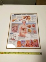 Vintage 1992 Anatomical Chart &quot;Understanding Diabetes&quot;, Doctor Office Display - £27.65 GBP