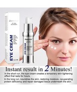 30ml Eye Cream Peptide Vitamin E Retinol Hyaluronic 2 Minutes Eye Bag Re... - £14.99 GBP