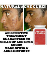 CLEARDERM ACNE PILLS STRONG TABLETS SPOT-FREE CLEAR GLOWING YOUTHFUL SKIN! - $23.98