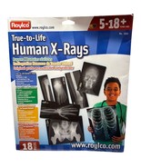 Roylco True-To-Life Human X-Rays Educational Kit 18 Pieces Ages 5+ Scien... - $19.20