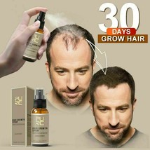 Magical Hair Growth Spray Beard Growth Eyelash Growth Hair loss Prevention Spray - £6.36 GBP+