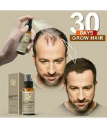 Magical Hair Growth Spray Beard Growth Eyelash Growth Hair loss Preventi... - £6.31 GBP+