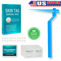 Micro Skin Tag Remover Device Kit Safe Painless Removal Bands Tool For 2-4Mm - £11.05 GBP