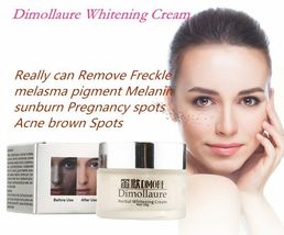 3 PCS Strong effect Freckle melasma pigment Removal whitening cream  - £50.08 GBP