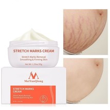 Pregnancy Cream Removes Maternal Skin Repair Body Scar Care Gentle Stretch Marks - £14.93 GBP
