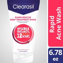 Clearasil Rapid Rescue Deep Treatment Wash Salicylic Acid Acne Medication 6.78 - £20.56 GBP