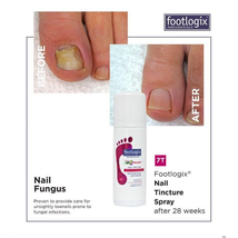 Footlogix Anti-Fungal Toe Tincture Spray, 1.7 Oz. image 3