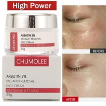 Alpha Arbutin 5% Strong Removal Melasma Whitening Cream Freckle Speckle Spots - £15.94 GBP
