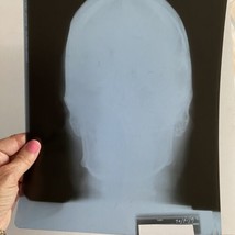 Real Head X-Ray Front View Film Sheet for Education Art 11.5x9.2in PII R... - $34.95