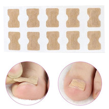 Nail Correction Stickers for Ingrown Toenails (50 count) - $5.99