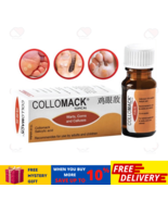 1 X COLLOMACK TOPICAL 10ml Painless Remover Plantar Warts Corns And Call... - $392.21 MXN