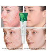 4 PK Laikou Aloe Vera Acne Blackheads Removal Gel Skin Care Treatment Fa... - $13.47 CAD