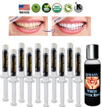 Activated Charcoal Gel for Natural Teeth Whitening - Fresh Teeth Whitener - USA  - £13.54 GBP