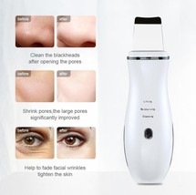 Amazefan Ultrasonic Skin Scrubber Peeling Shovel Ion Acne Blackhead Remover Deep - £14.68 GBP