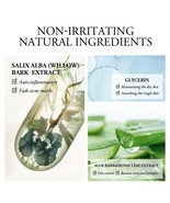 Laikou Aloe Vera Acne Blackheads Removal Gel Skin Care Treatment Face Cream - $7.67